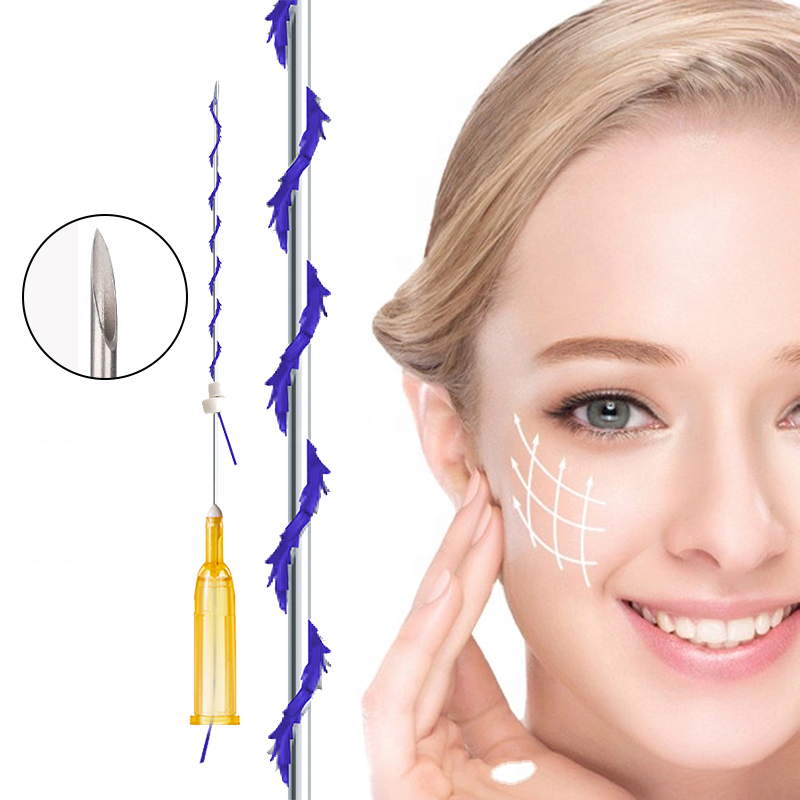 PDO Mini Cog Screw Thread for Face Body Neck Lifting