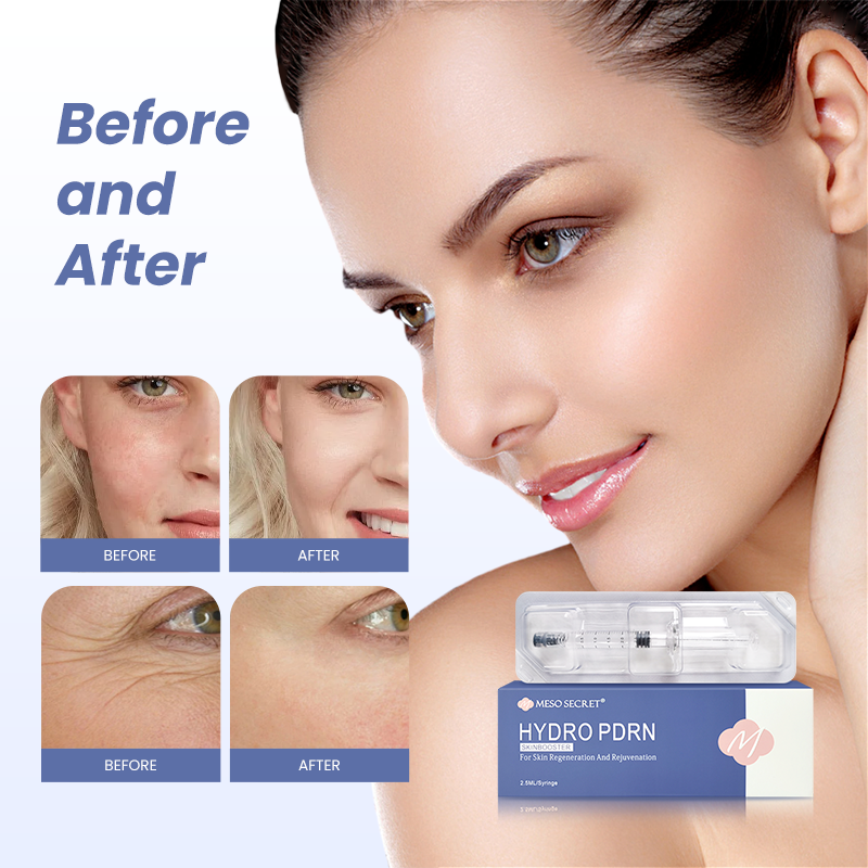 HYDRO PDRN Improve Skin Elasticity