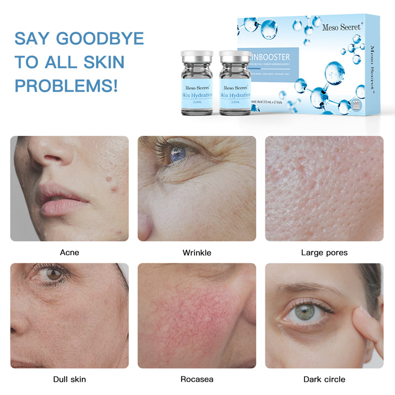 Meso Secret Skinbooster Gives the Skin an Overall Healthy Glow