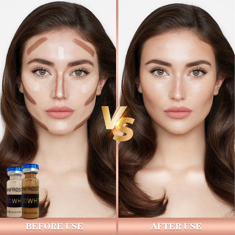 Meso White Brightening Serum for Skin Whitening Treatment