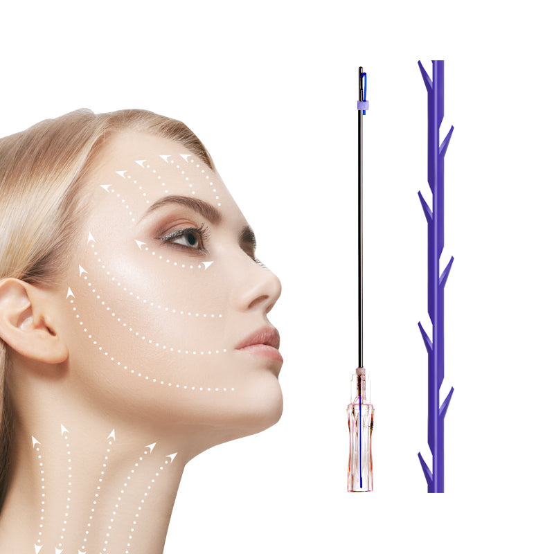 PDO Z Type /Whale /Shark Molding Thread for Glabella Face Abdomen Breast Neck Lifting