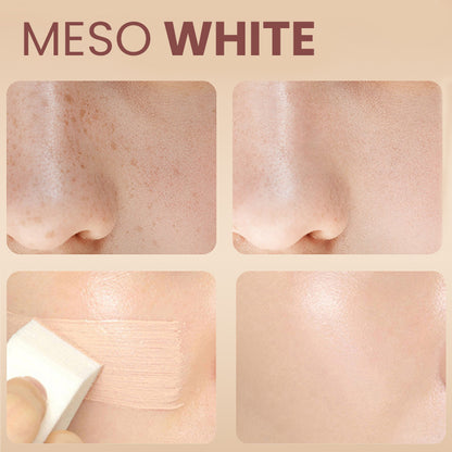 Meso White Brightening Serum for Skin Whitening Treatment