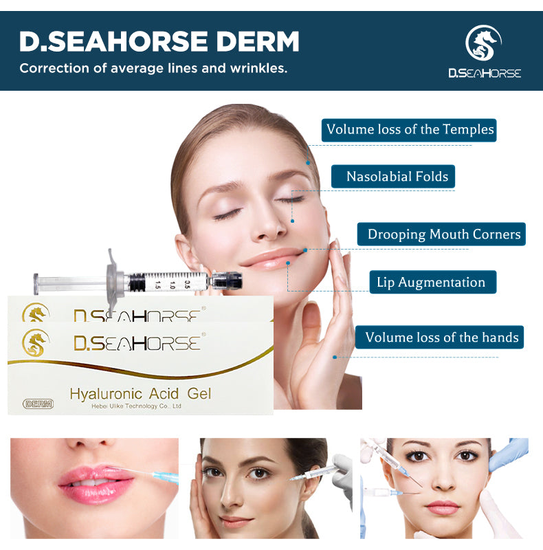 Relleno de ácido hialurónico “Derm” D.seahorse para sienes, pliegues nasolabiales, manos, boca, labios