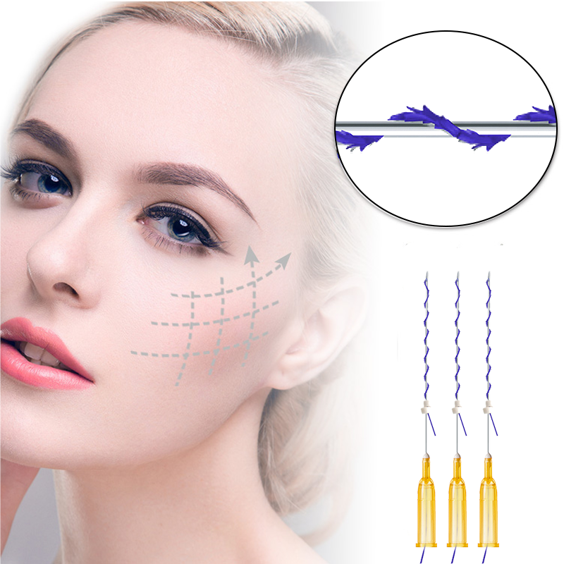 PDO Mini Cog Screw Thread for Face Body Neck Lifting