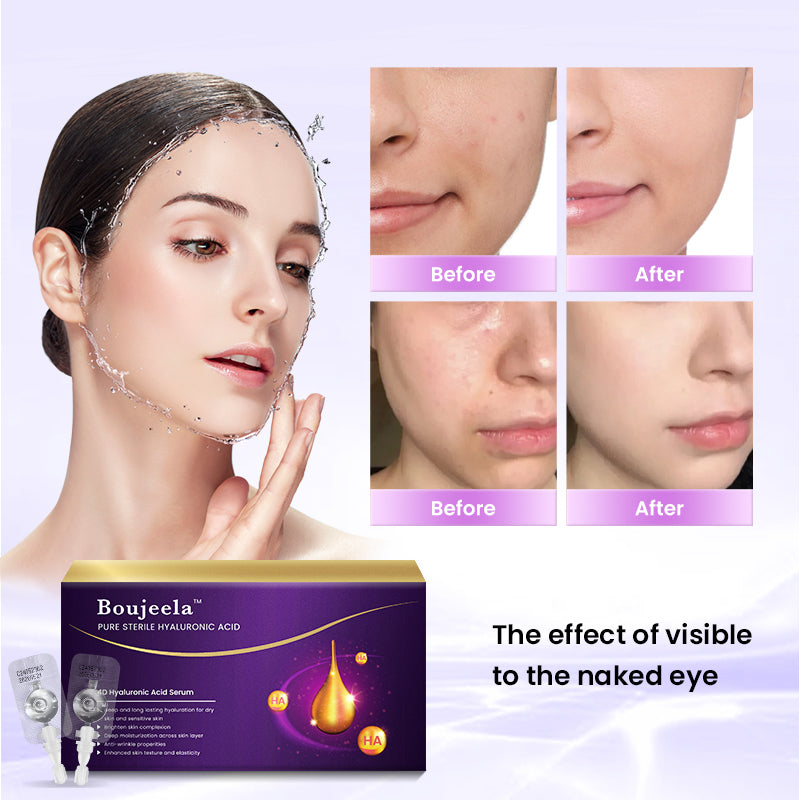 4D Hyaluronic Acid Serum for Ultimate Skin Hydration